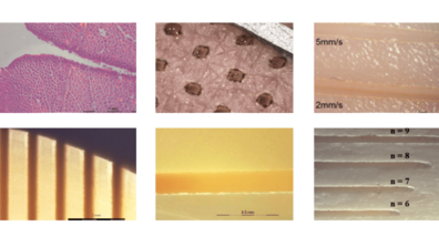 Medical application Examples Laser treatment tissue research cold ablation Pantec Biosolutions bone Aesthetics dermatology opthalmology dentistry ENT Orthopedics Lithotripsy